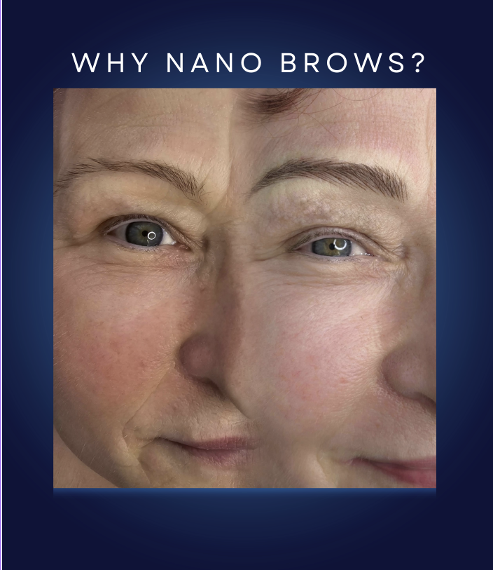 Nano Brows Example